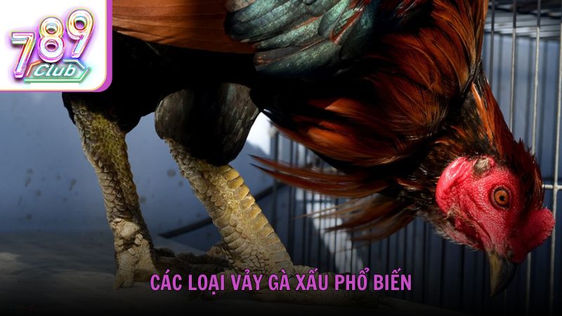 Các loại vảy gà xấu phổ biến cần tránh